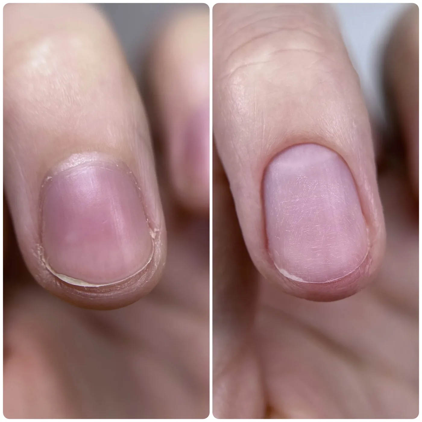 Russian combi manicure before and after example
