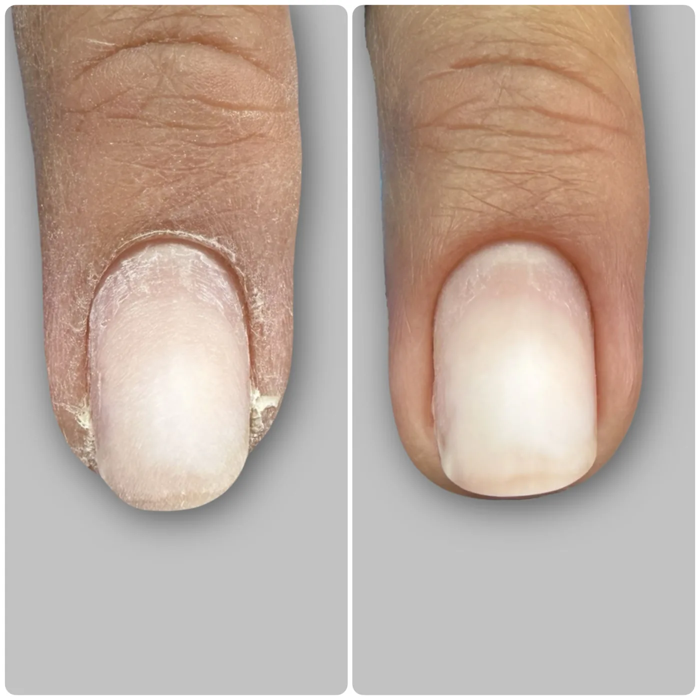 Russian combi manicure before and after example